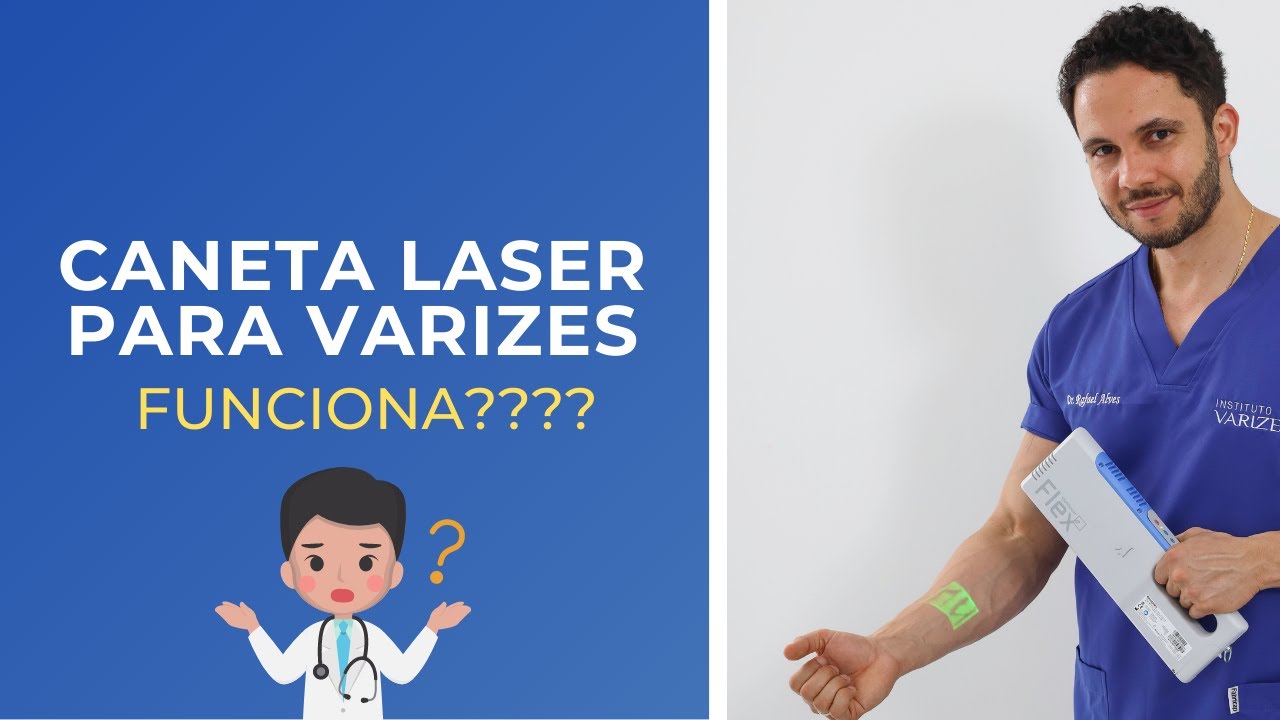 Caneta laser para varizes funciona ???