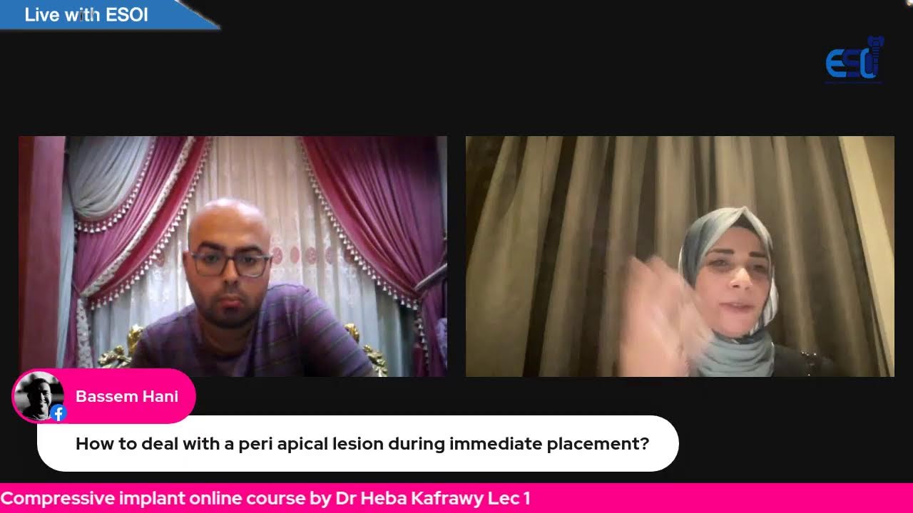 Compressive implant online course by Dr Heba Kafrawy Lec 1