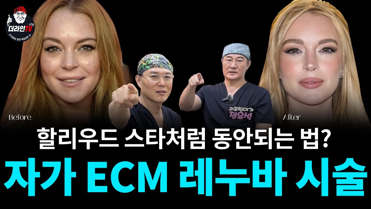 할리우드 스타처럼 동안 가능? │자가 ECM 레누바 전격 공개