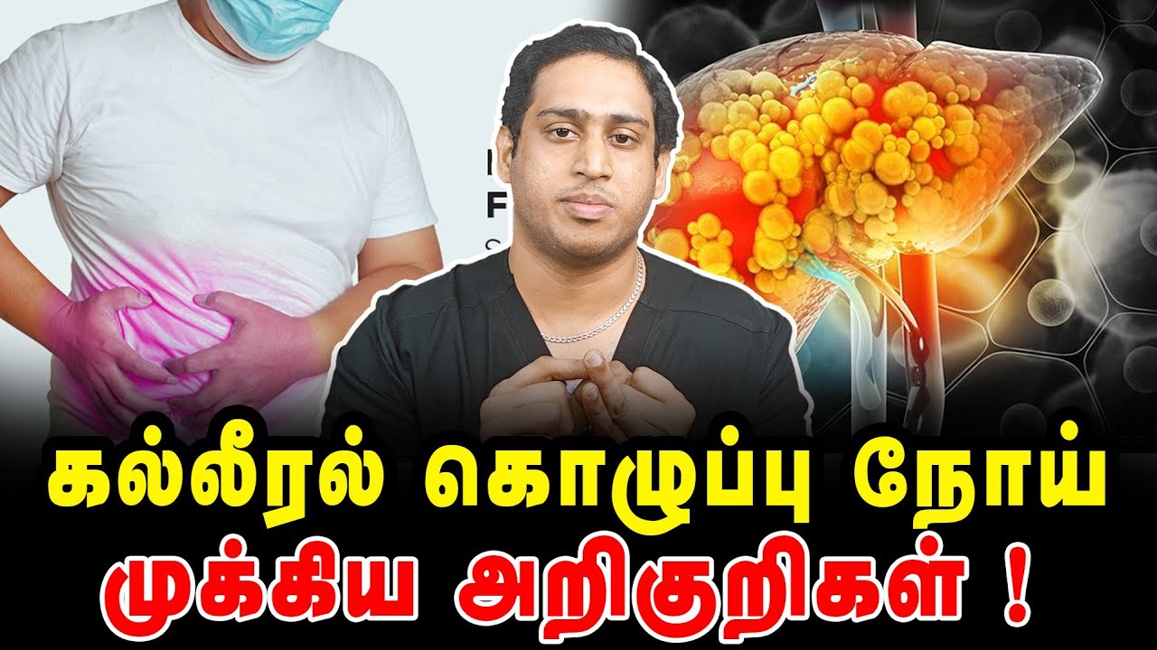 கல்லீரல் கொழுப்பு நோய் முக்கிய அறிகுறிகள்|Fatty liver disease symptoms|APRI index in Fatty liver