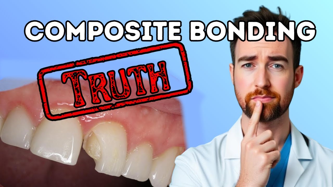 Composite Bonding: What your Dentist doesn't tell you (but I will)