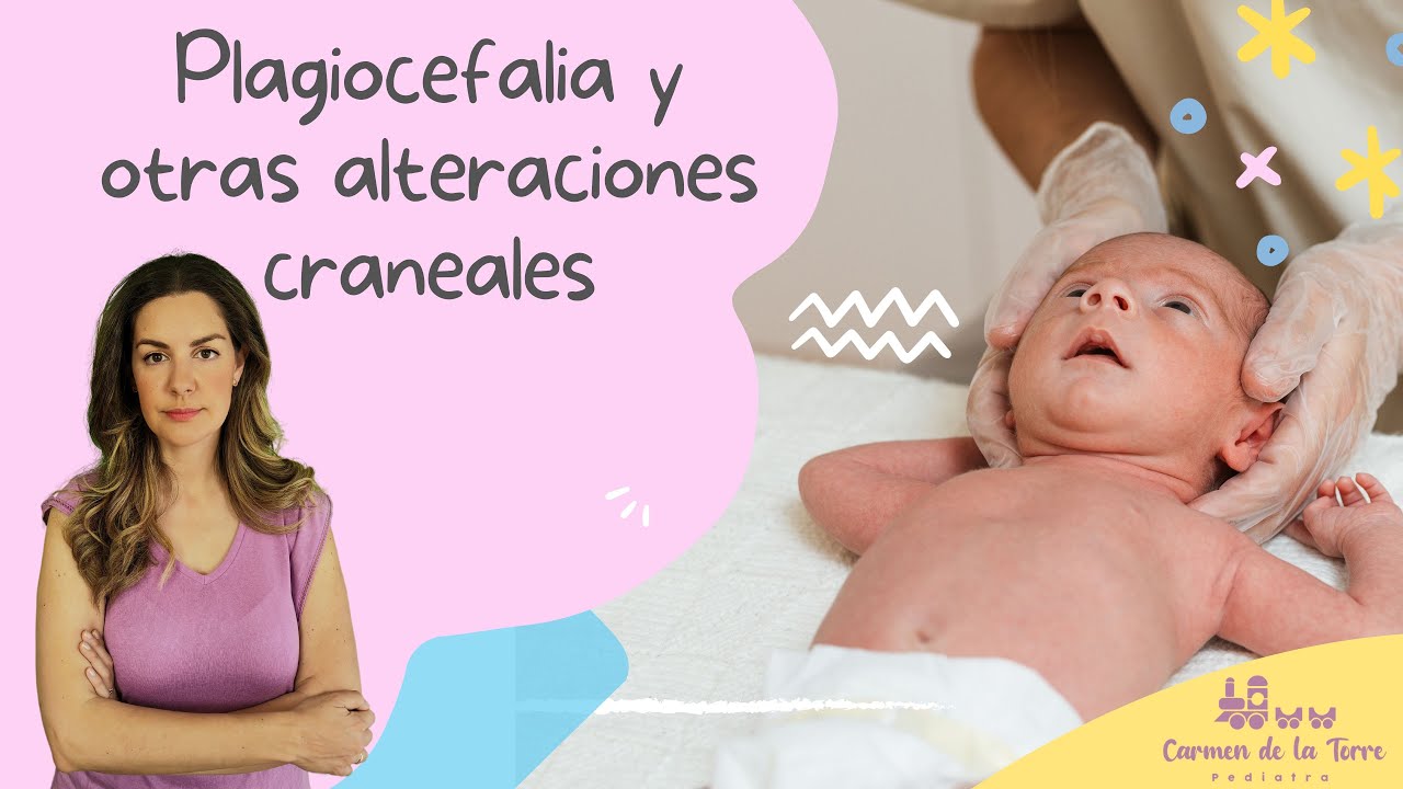 PLAGIOCEFALIA en bebés y otras alteraciones craneales