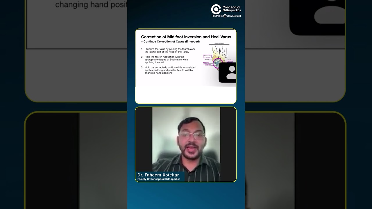 Correcting Mild Foot Inversion & Heel Varus: Simple Clinical Approach by Dr. Faheem Kotekar