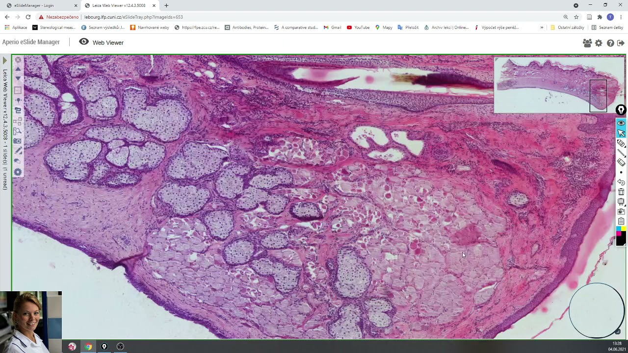 palpebra (eyelid)