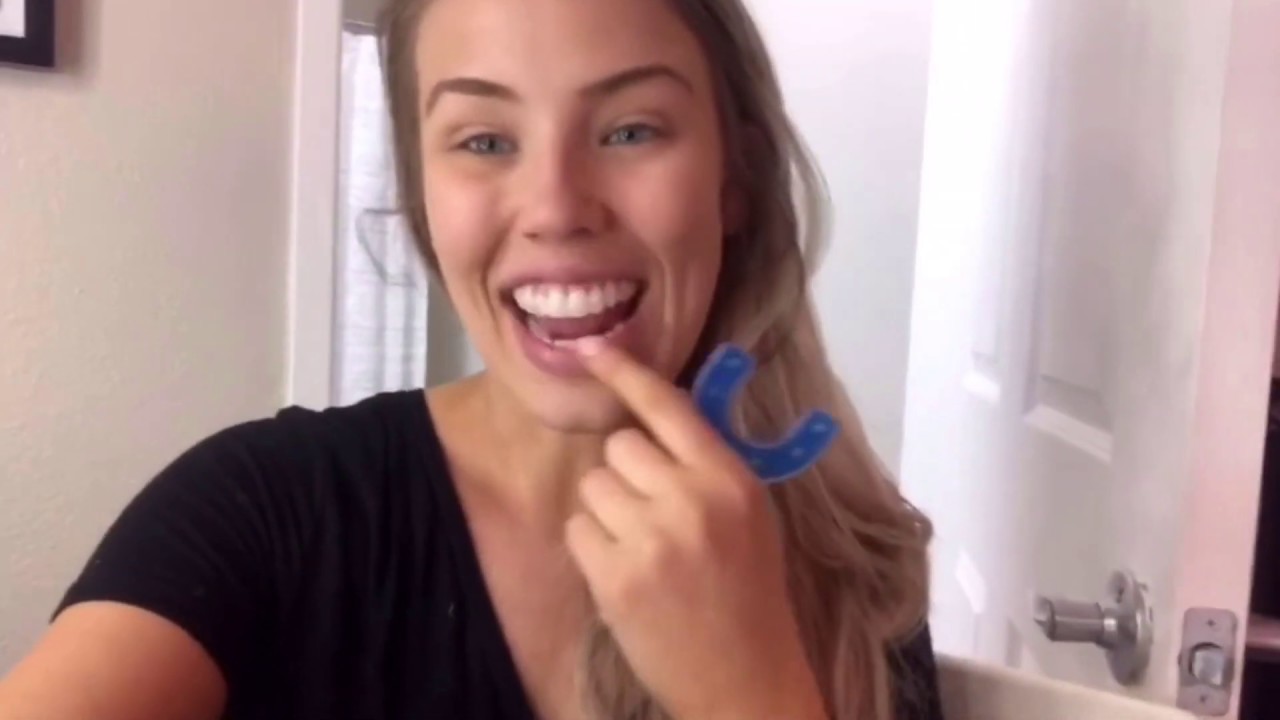 Brittany VPro Progress | Propel Orthodontics