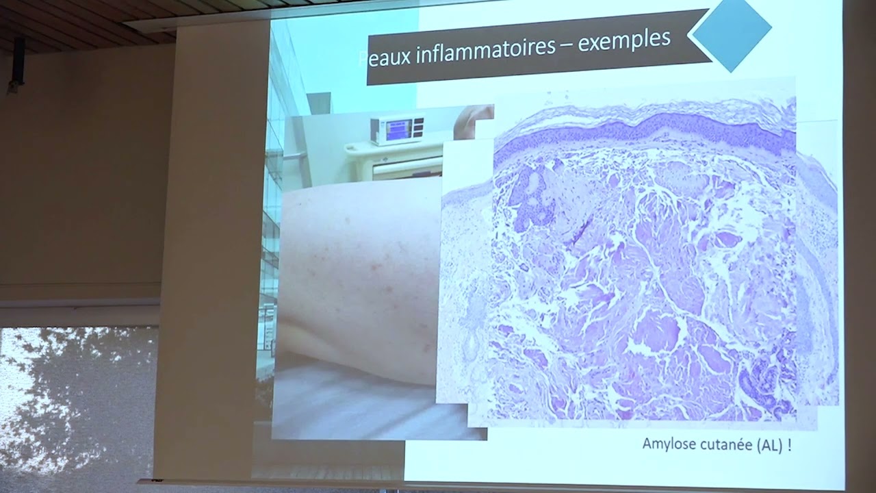 De la dermatologie à la dermo-pathologie - Conférence du Quoi de neuf à l'HNFC ? - 13 juin 2023