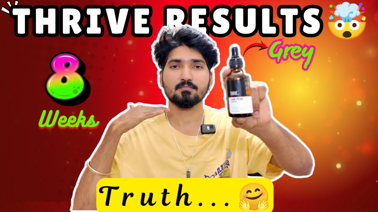 Thrive Grey Hair Serum Review🤠: My Honest Results After 8 weeks💀 