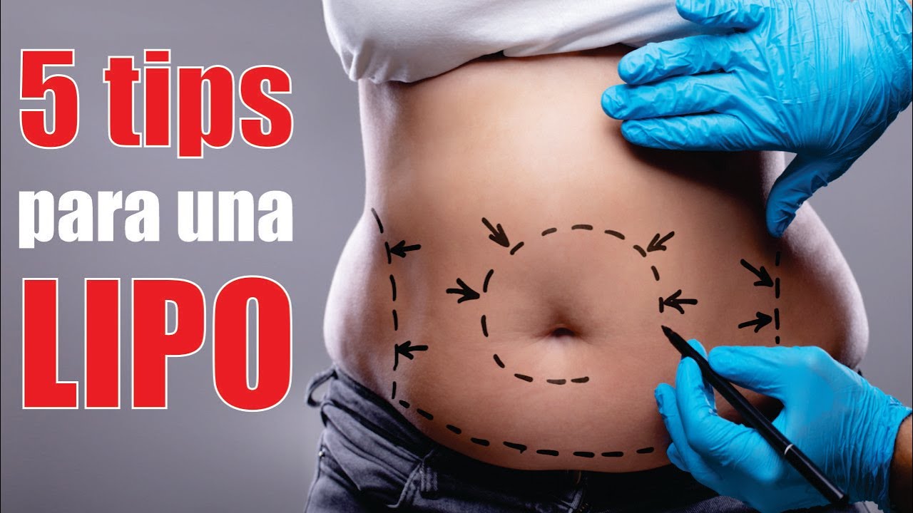5 TIPS para la mejor LIPO 👙 LIPOESCULTURA de IMPACTO 🩺 Dr ALBERTO CALVO QUIROZ