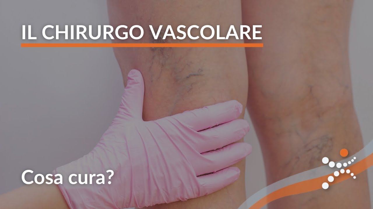 Chirurgo Vascolare: Chi è e Cosa Fa? | Guida Completa