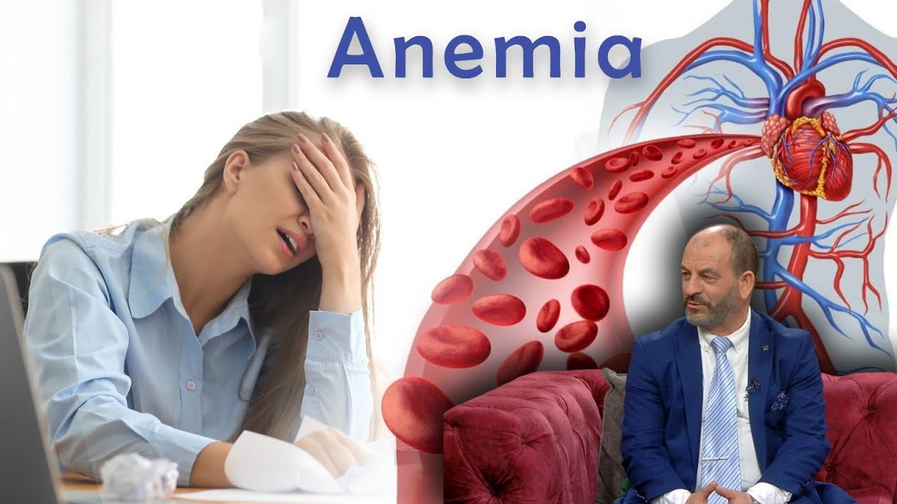 Anemia e përgjumja e pranverës, ja sëmundjet që fshehin e si mund të trajtohen | ABC News Albania