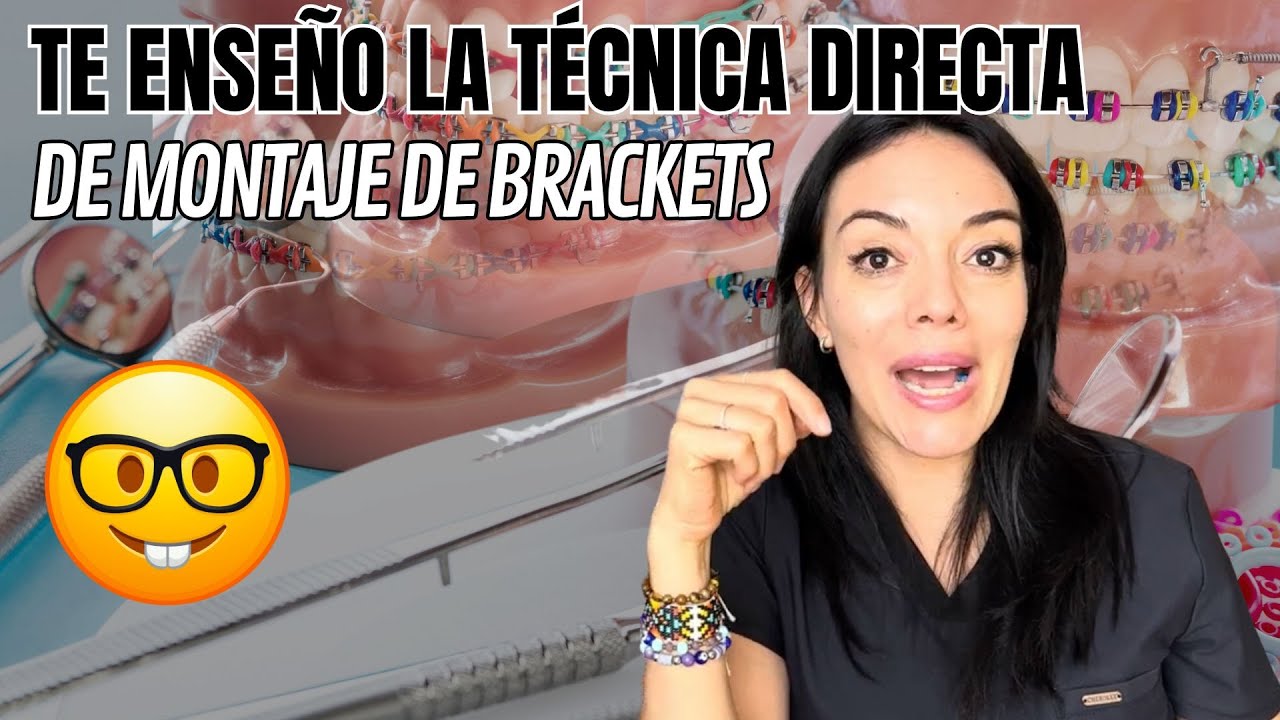 ORTODONCIA paso a paso, una explicación completa del montaje directo de BRACKETS