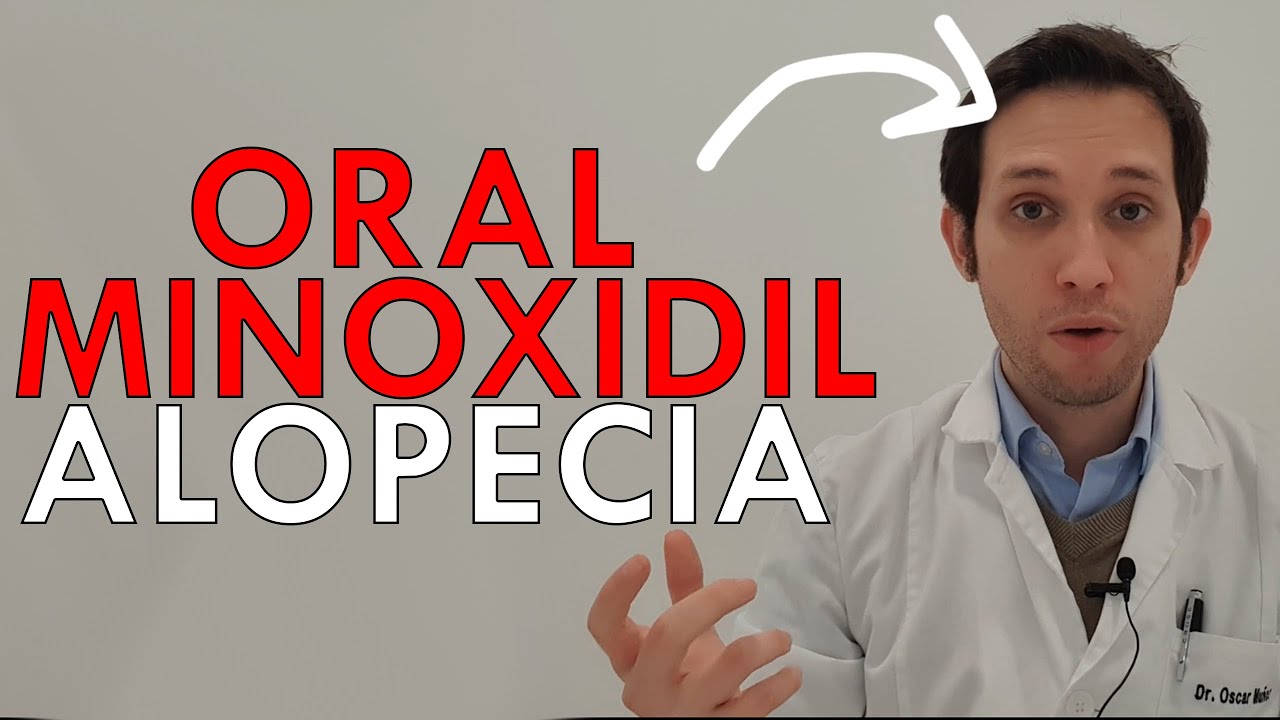 DOCTOR te cuenta MINOXIDIL ORAL para tu ALOPECIA