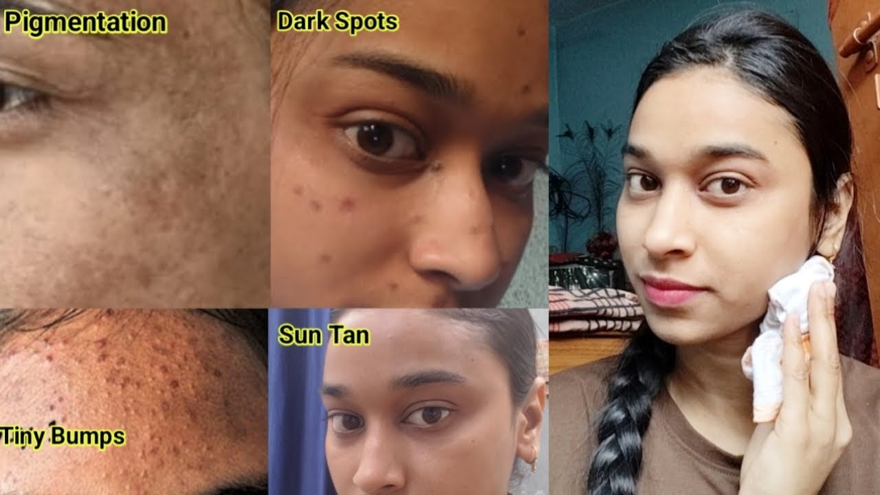 Get Crystal Clear Skin in Just 3 days 🌸