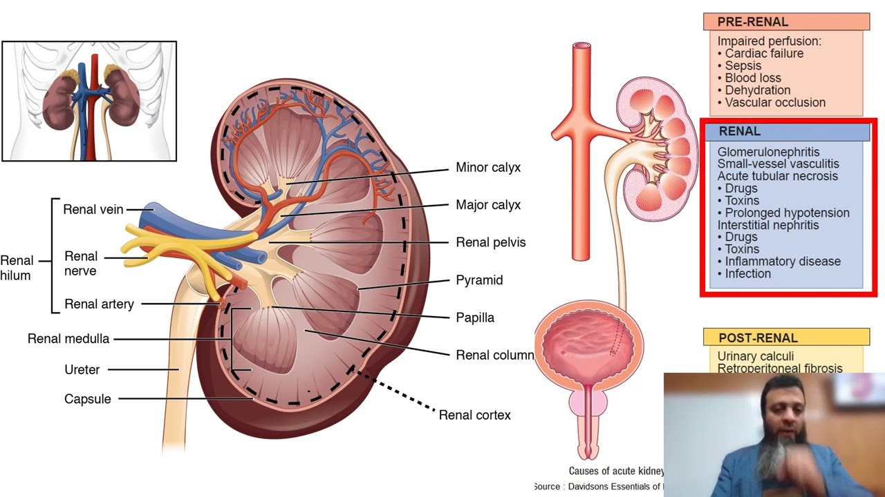 Glomerulonephritis basics Dr. Ahmed Yehia, MD Internal Medicine, Faculty of Medicine, Beni-Suef