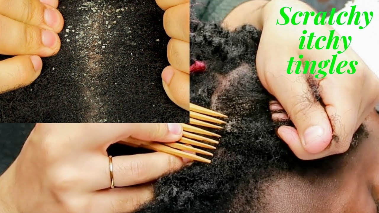 ASMR Itchy Tingly Scalp Scratching for sleep 😴☁️