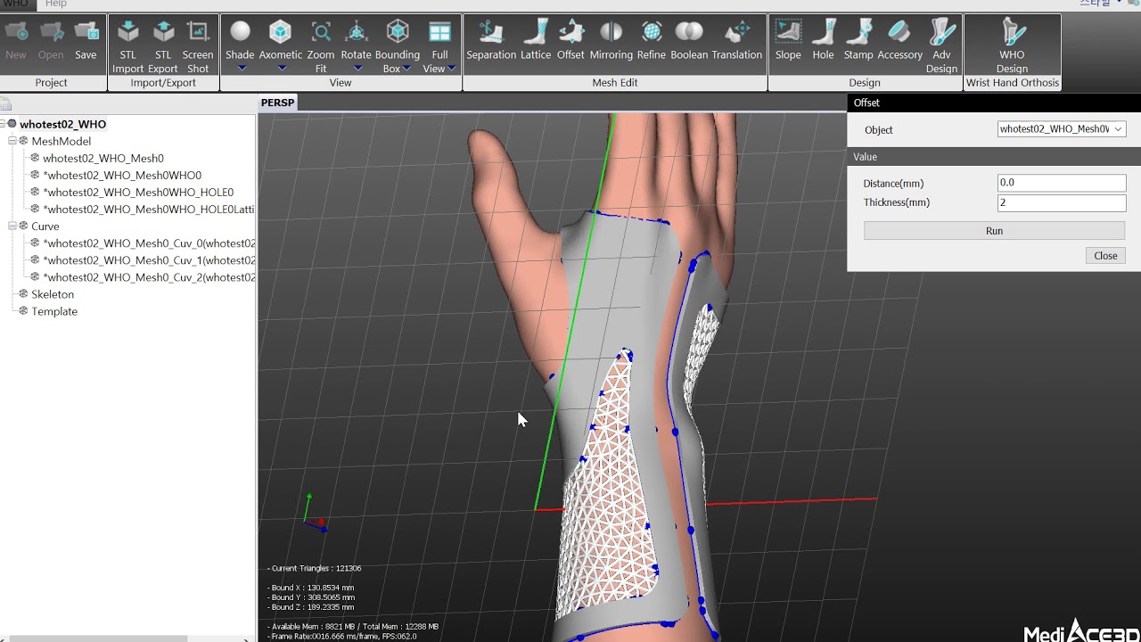 01 Design & 3 print wrist brace with MediACE3D.