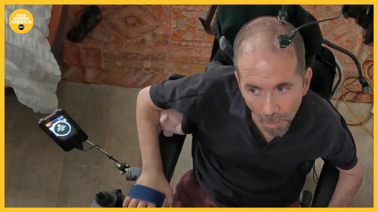 Man speaks again in medical-first brain implant breakthrough