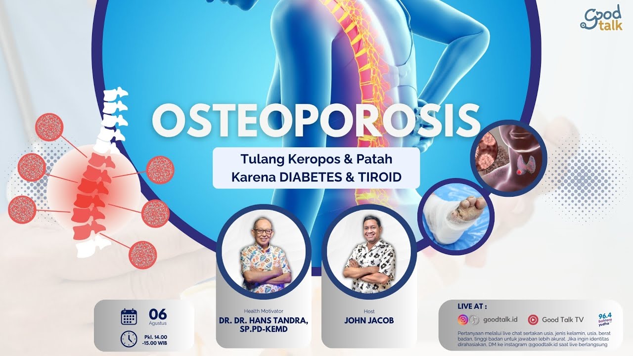 OSTEOPOROSIS (Tulang Keropos & Patah karena Diabetes & Tiroid) | Good Talk LIVE