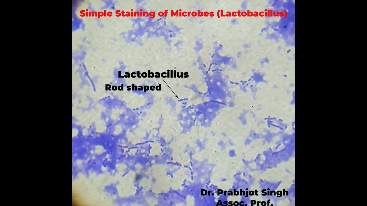 Simple staining of Bacteria  (Lactobacillus)