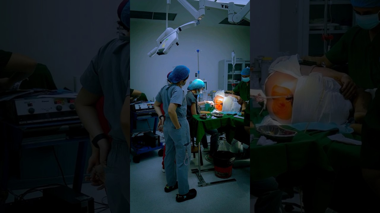 What REALLY Happens When You're Asleep During Surgery? #generalanesthesia  #Surgery #anesthesiology