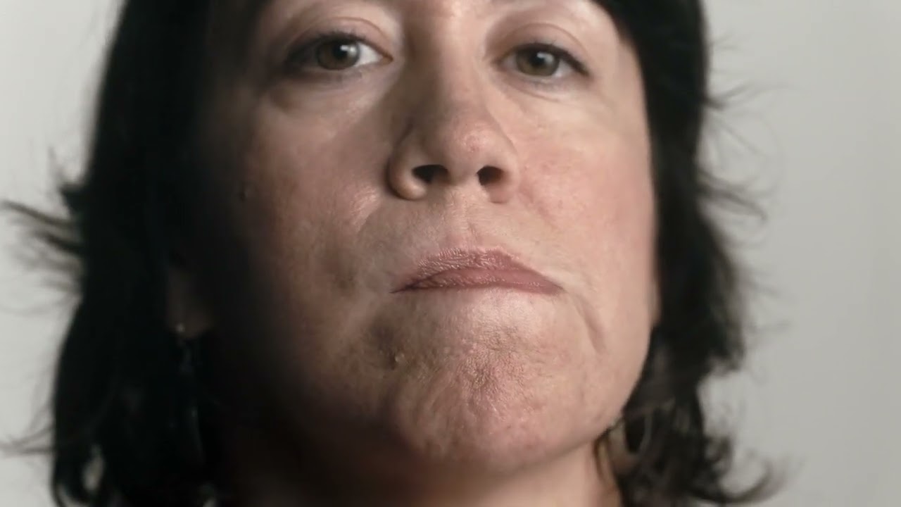 Tardive Dyskinesia Movements