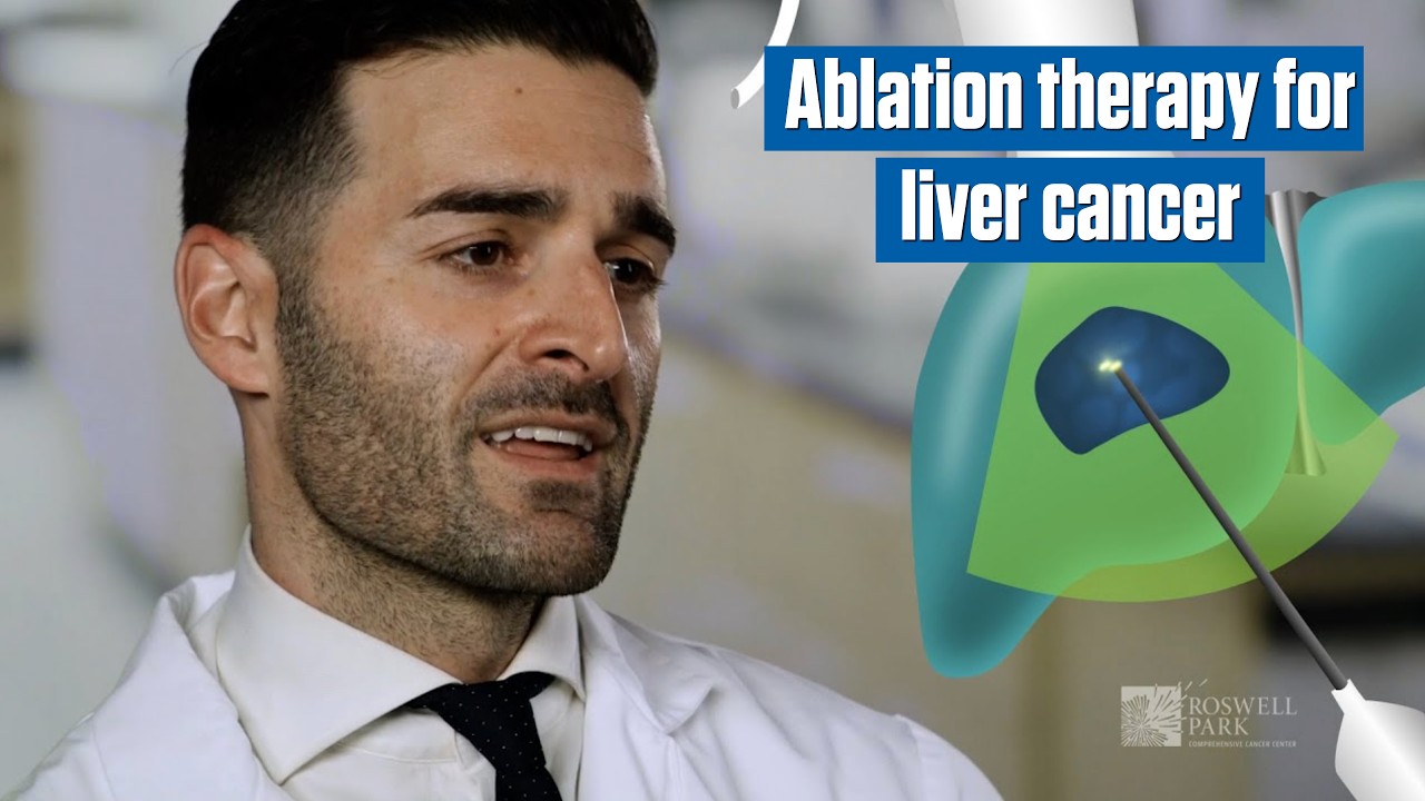 What is Ablation of the Liver?