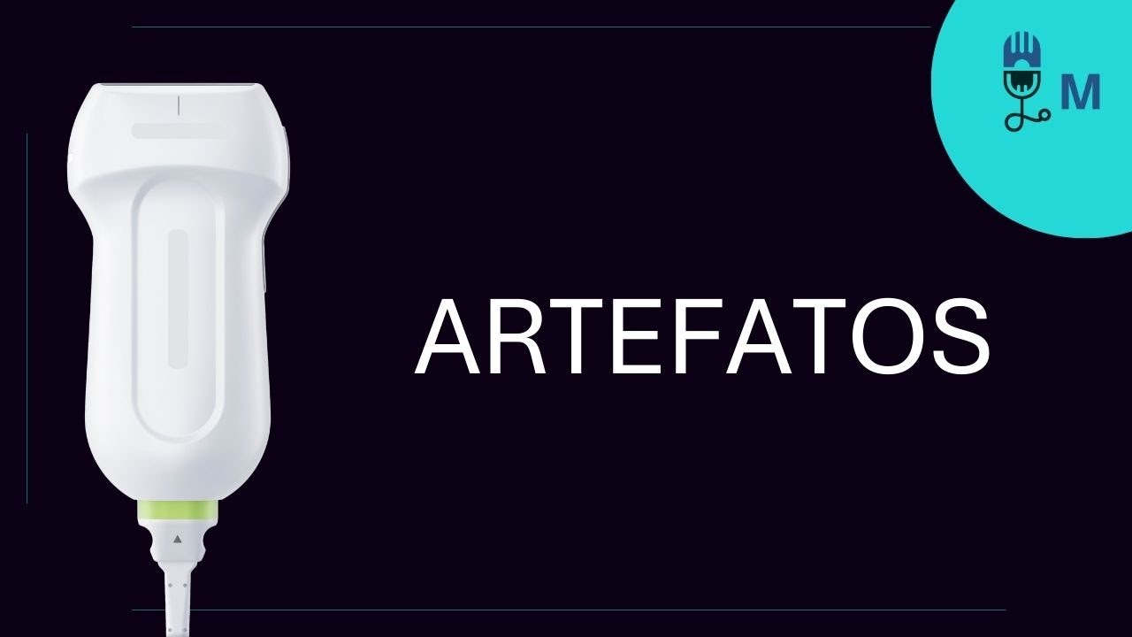 #56-Artefatos