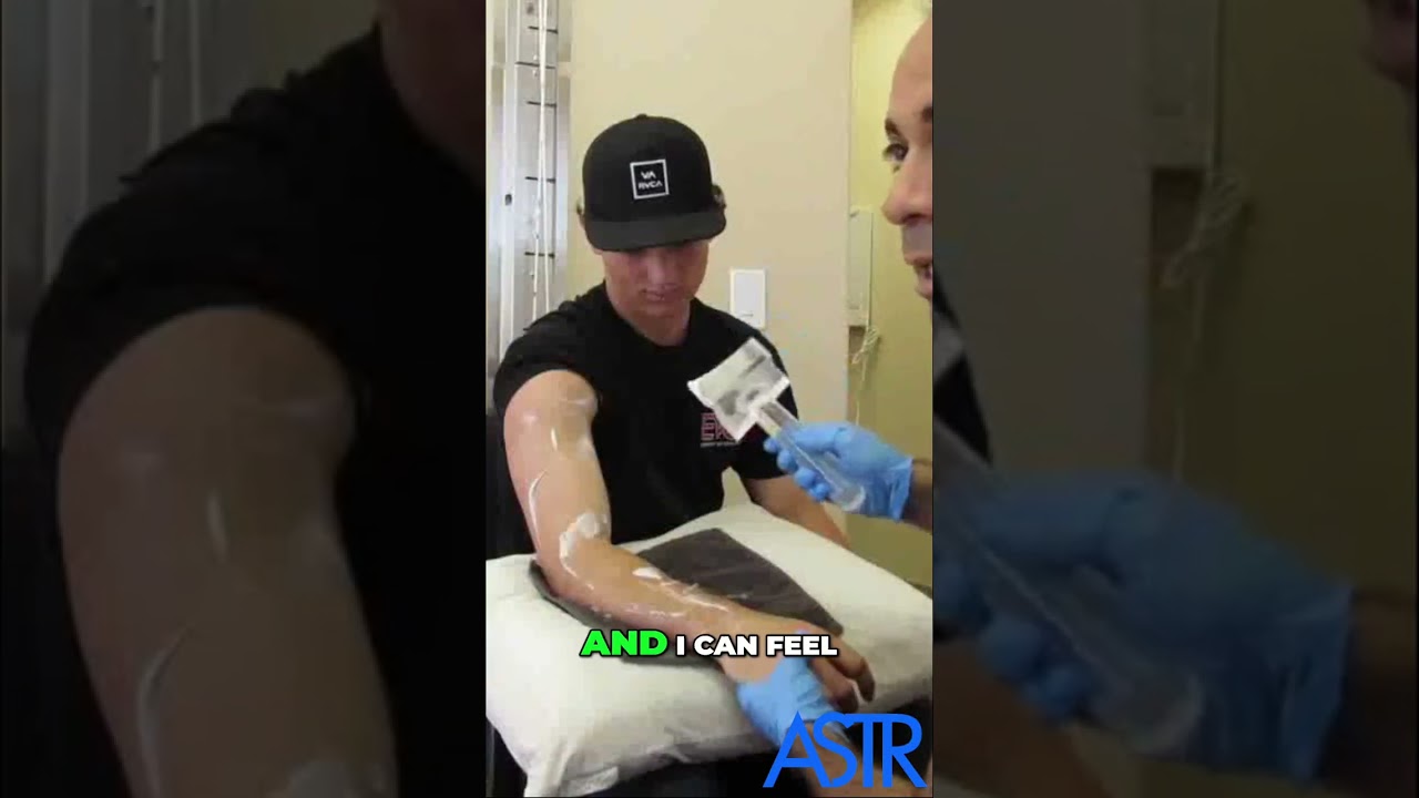 💪 See Elbow Scar Tissue Treatment in Action! ✨