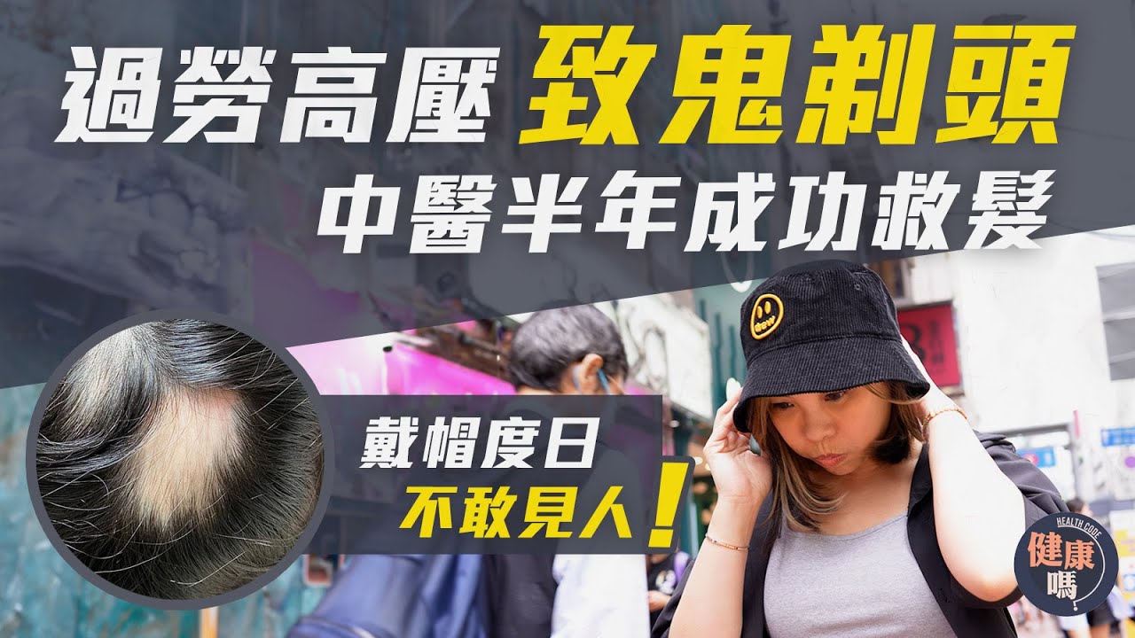 「鬼剃頭」睇西醫大半年  脫髮窿反由一個變三個｜轉中醫半年斑禿痊癒 兼改善長期失眠｜健康嗎