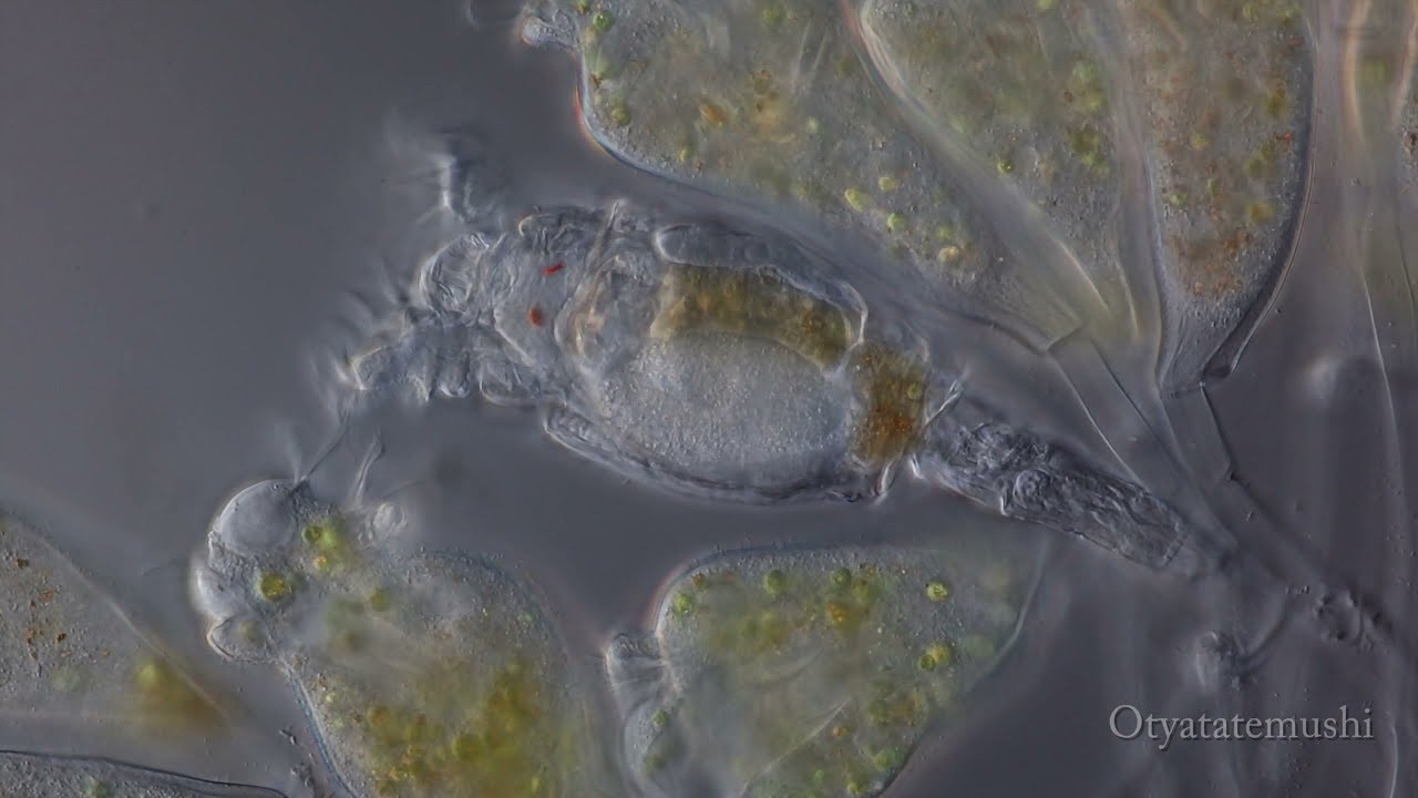 エピスティリスとヒルガタワムシ（Epistylis and Bdelloid rotifer）