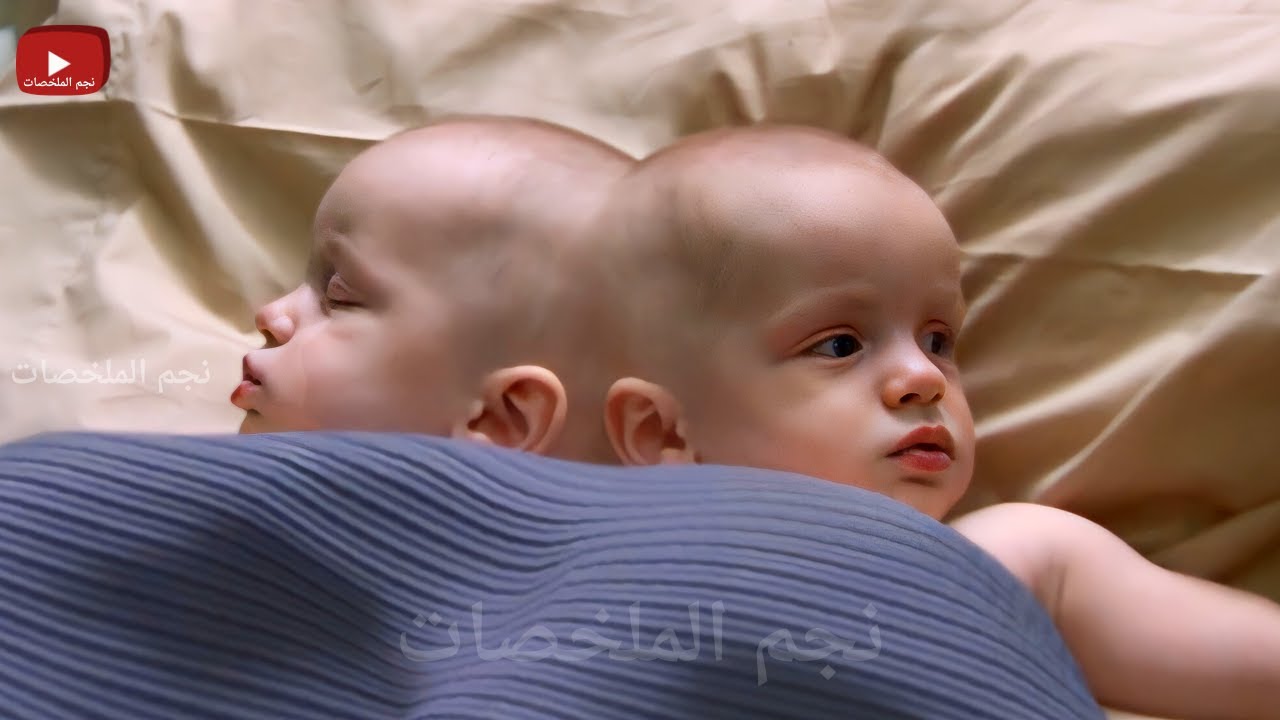 قصة حقيقية - دكتور بيتعرض للتنمر لكنه بيقوم بعملية فصل توأم ملتصق وبيصبح أفضل دكتور جراح فى العالم