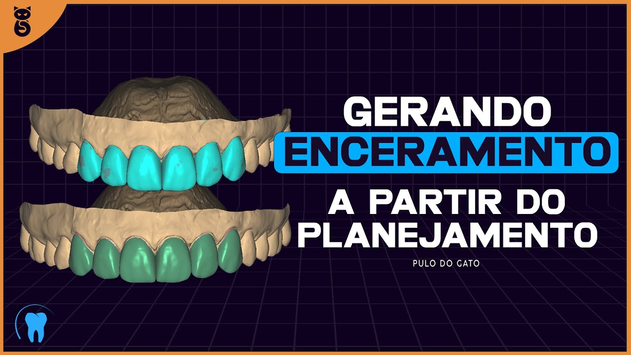EXOCAD : Gerando enceramento a partir do Planejamento DIGITAL