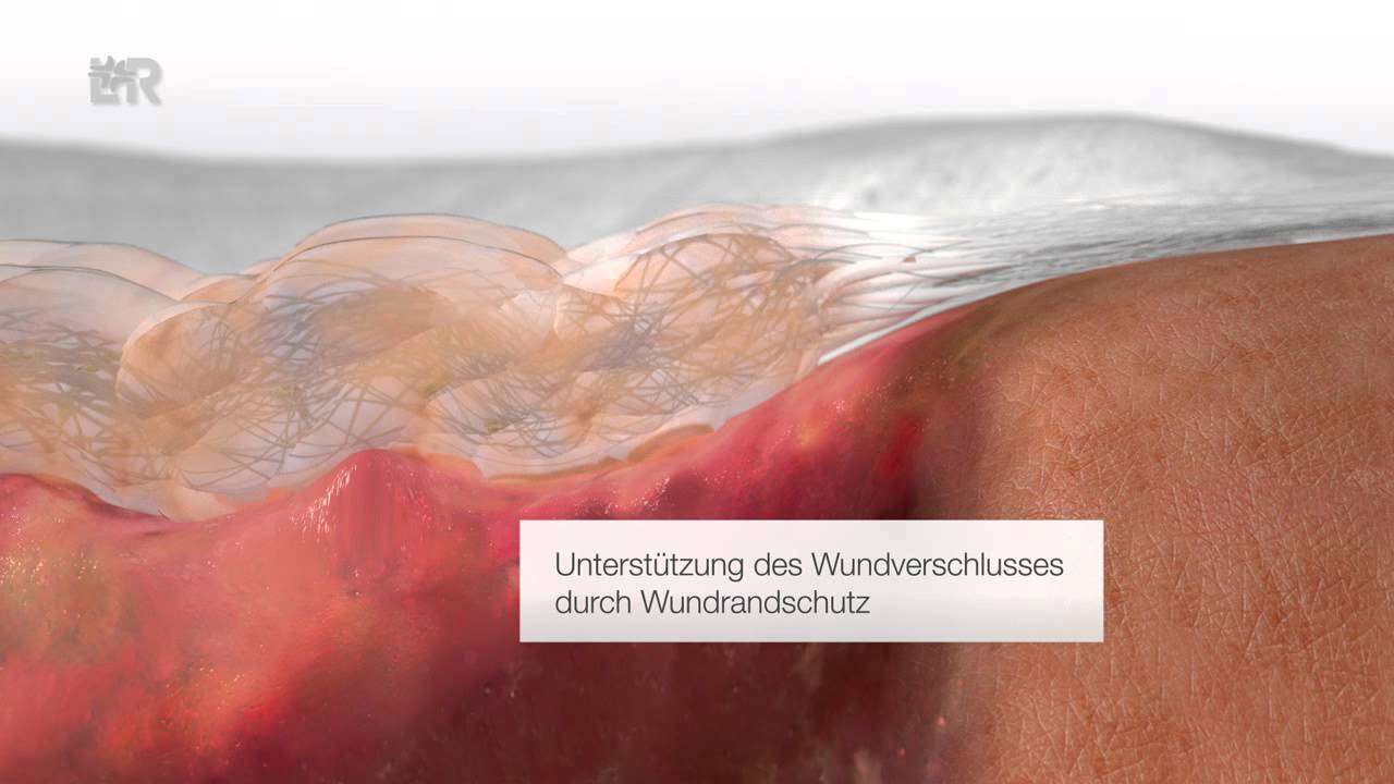 Suprasorb® Liquacel (Deutsch)