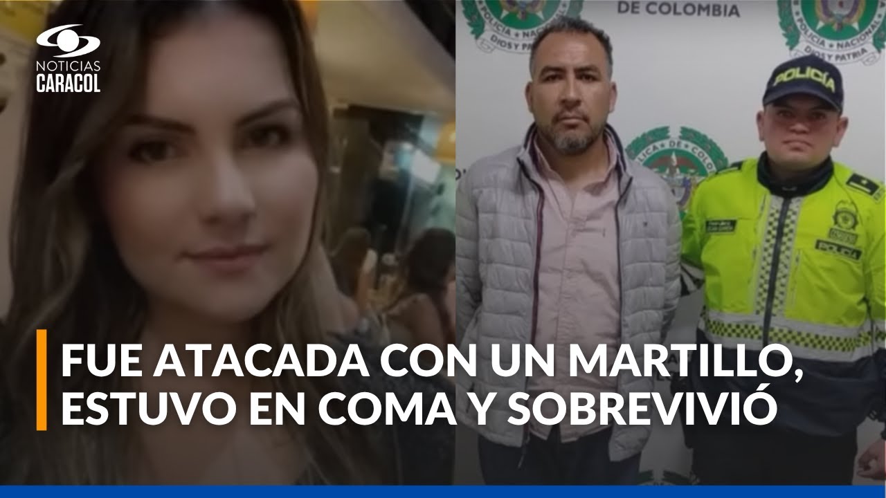 La historia de la mujer que sobrevivió a brutal ataque con martillo por parte de su expareja
