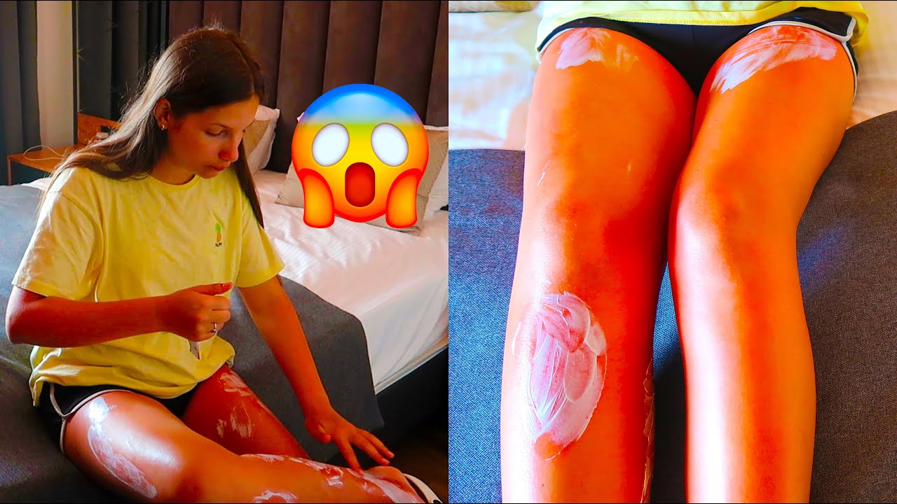 Irochka s-a Ars la Picioare / Nu poate sa mearga