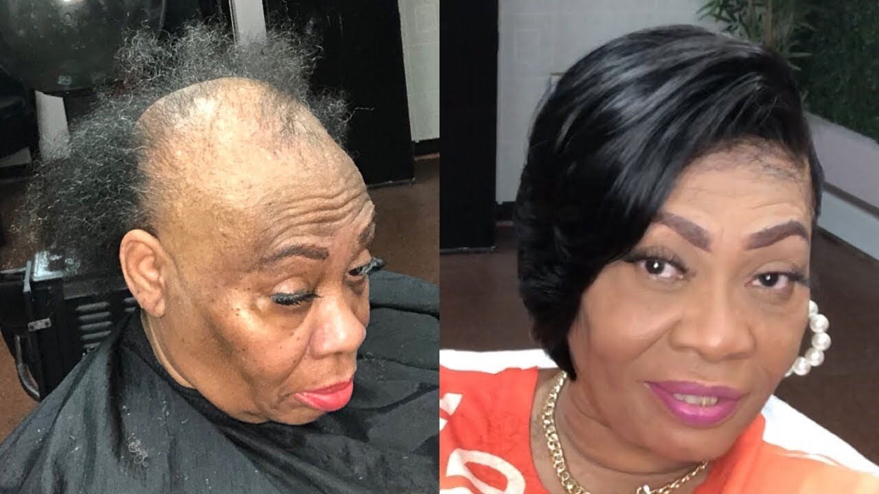 MUST WATCH !!!!ALOPECIA AREATA TRANSFORMATION | LAYED QUICKWEAVE BOB DEEP SIDE PART
