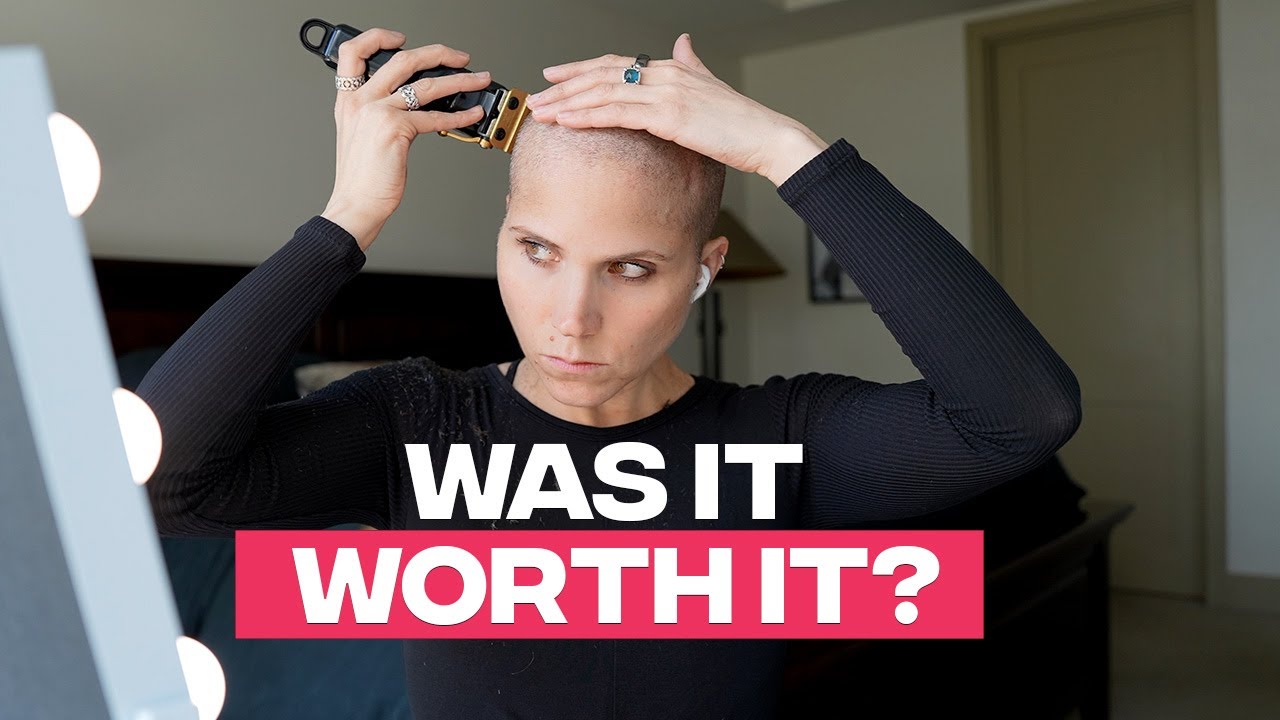 2 Years Later: Why I Shaved My Head for Hair Loss — Was It Worth It?