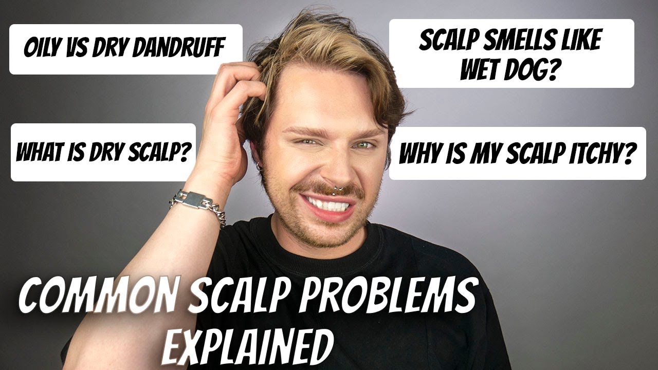 MOST POPULAR SCALP ISSUES | FAQ About Scalp Issues | Why Is My Scalp Smelly