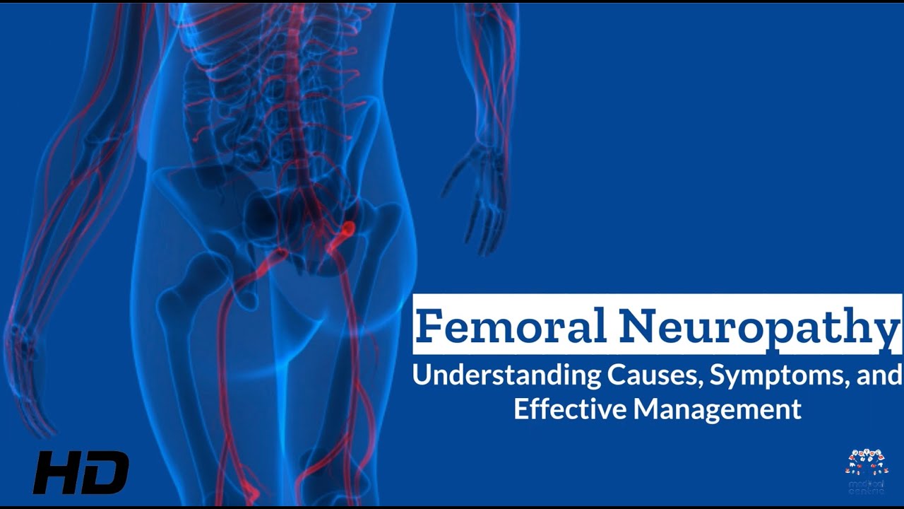 Femoral Neuropathy Unveiled: What You Need to Know