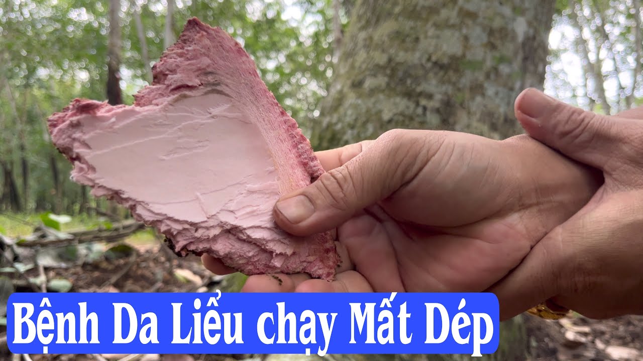 Bệnh Da liễu chạy Mất Dép khi gặp Vỏ Cây này, trị viêm nang lông, nấm da, viêm da đầu, nấm móng. PH