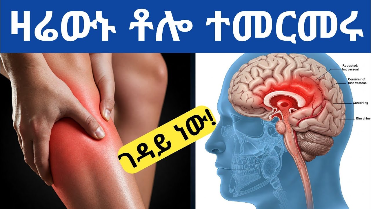 የቫይታሚን ዲ እጥረት ከባድ የማስጠንቀቂያ 10 ምልክቶች| የቫይታሚን ዲ እጥረት| ቫይታሚን ዲ Warning signs of vitamin d deficiency
