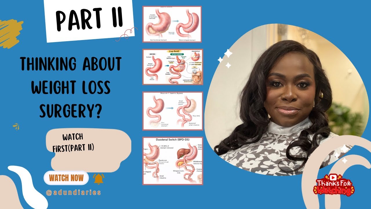 Before Weight-Loss Surgery: WHAT NO ONE TELLS YOU (Part 2)