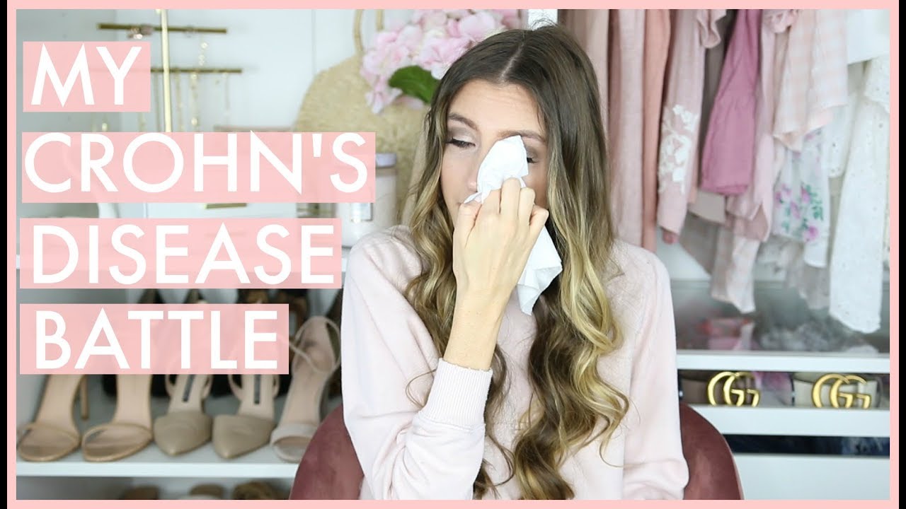 My Crohn's Disease Journey | my battle with an autoimmune disease