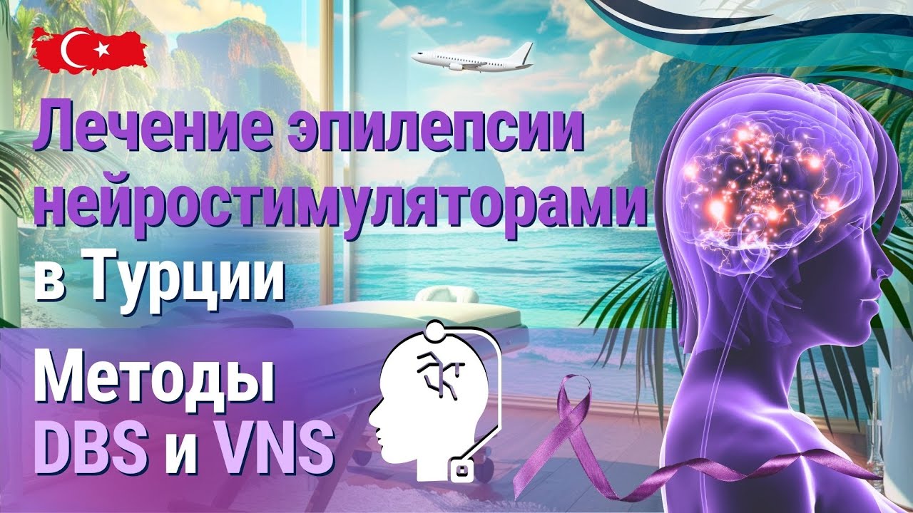 Эпилепсия под контролем: как методы DBS и VNS в Турции меняют жизни пациентов!