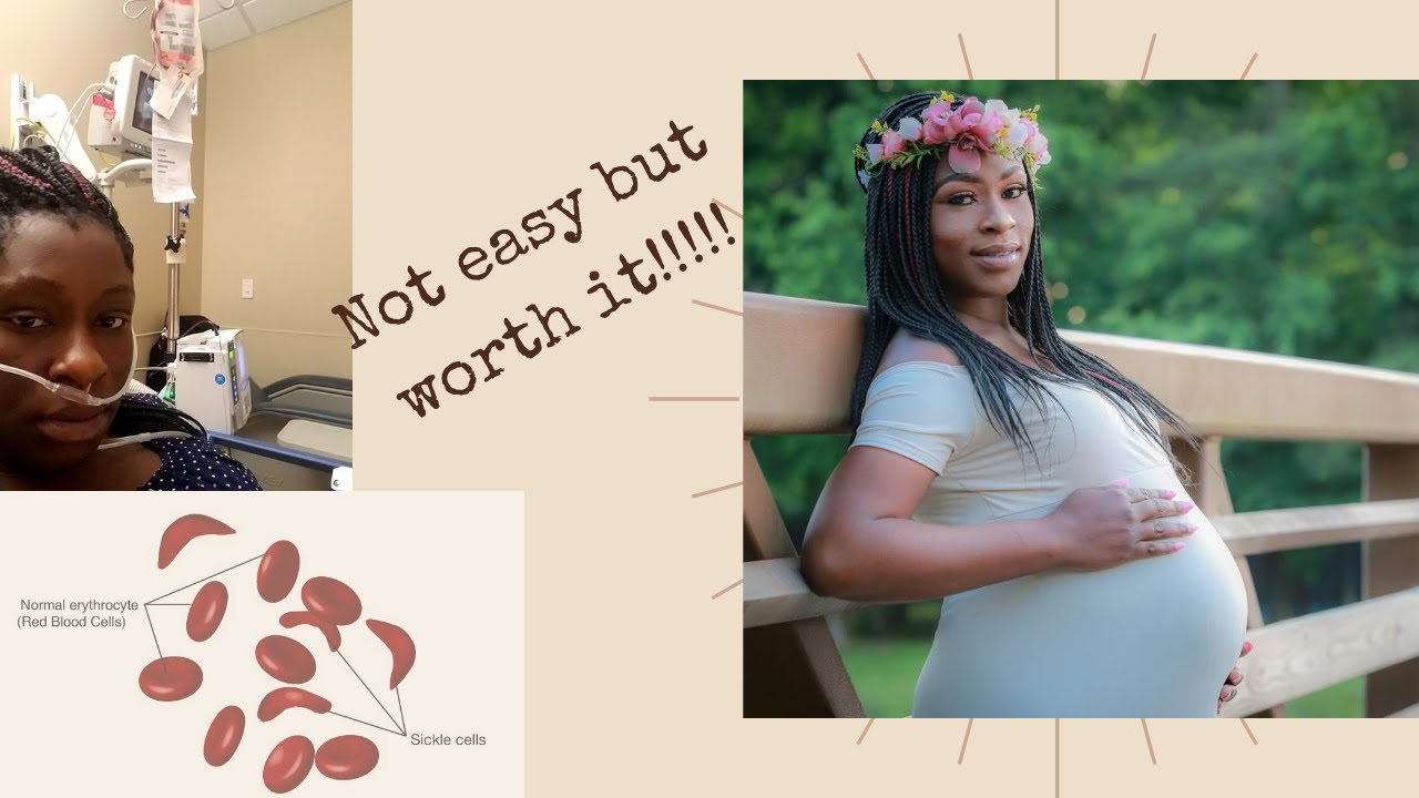 Going through Pregnancy with a medical diagnosis|Story Time|Sickle cell in pregnancy|Emotional