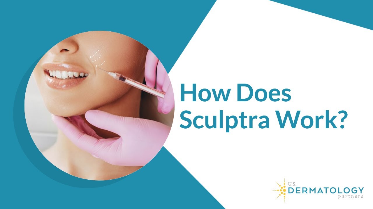 Sculptra Filler Treatment for Facial Volume