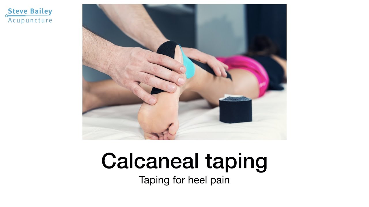 How to apply calcaneal taping for heel pain