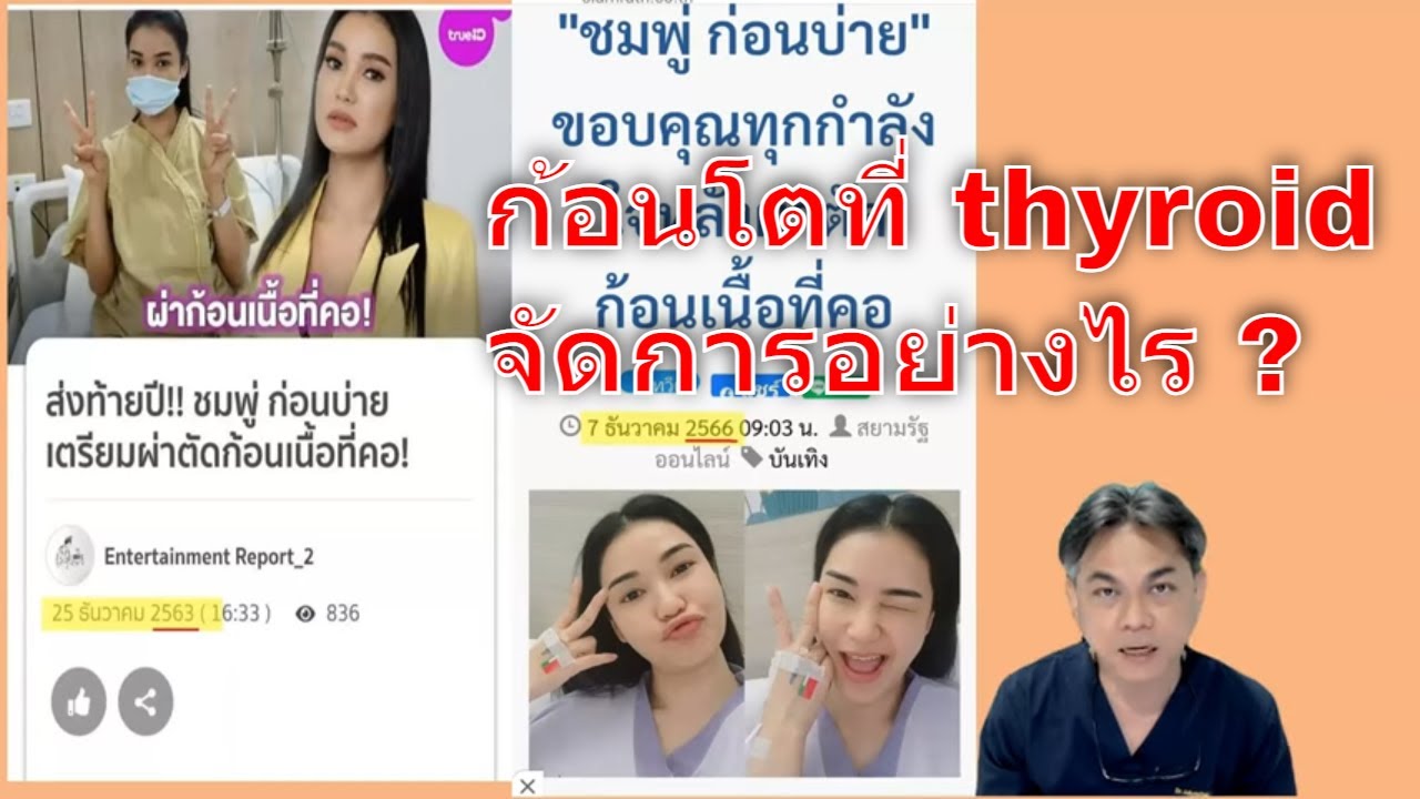คนดังกับโรค : ชมพู่ก่อนบ่าย กับ การผ่าตัดก้อนไทรอยด์แบบไม่มีแผลที่คอ