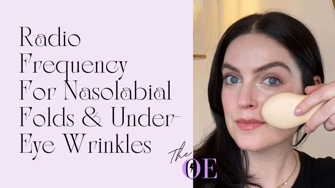 Nasolabial Fold Tightening and Under Eye Wrinkle Treatment with Nebulyft Radio Frequency