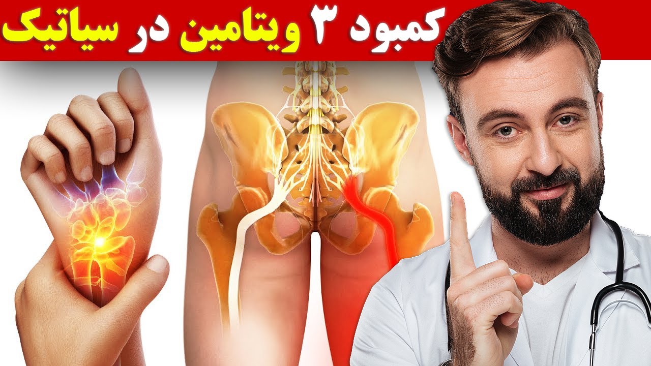 کمبود ۳ ویتامین که باعث سیاتیک و سندرم تونل کارپل می شود